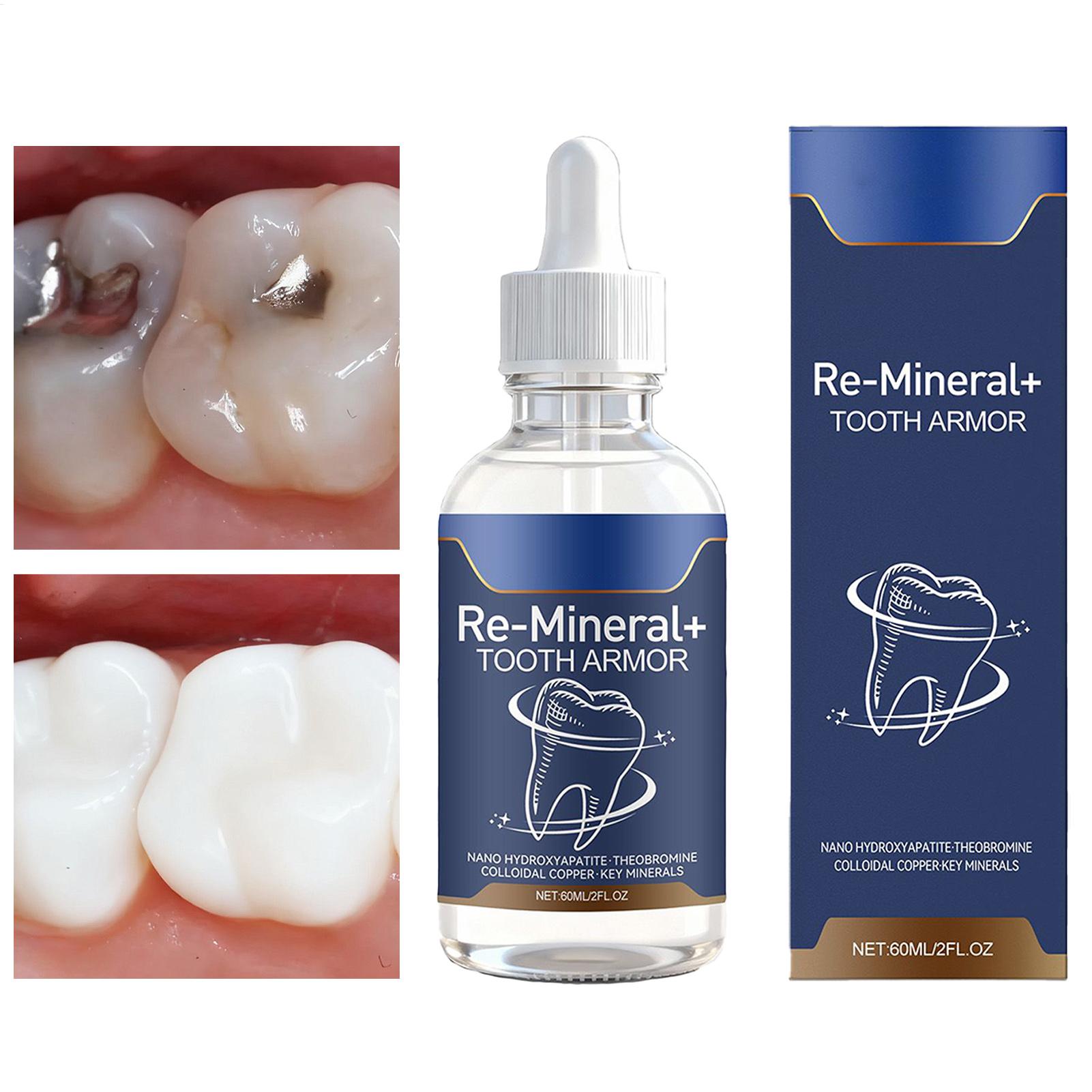 Teeth Whitening Gum - 60ml 치아 청소 액체는 치아 얼룩을