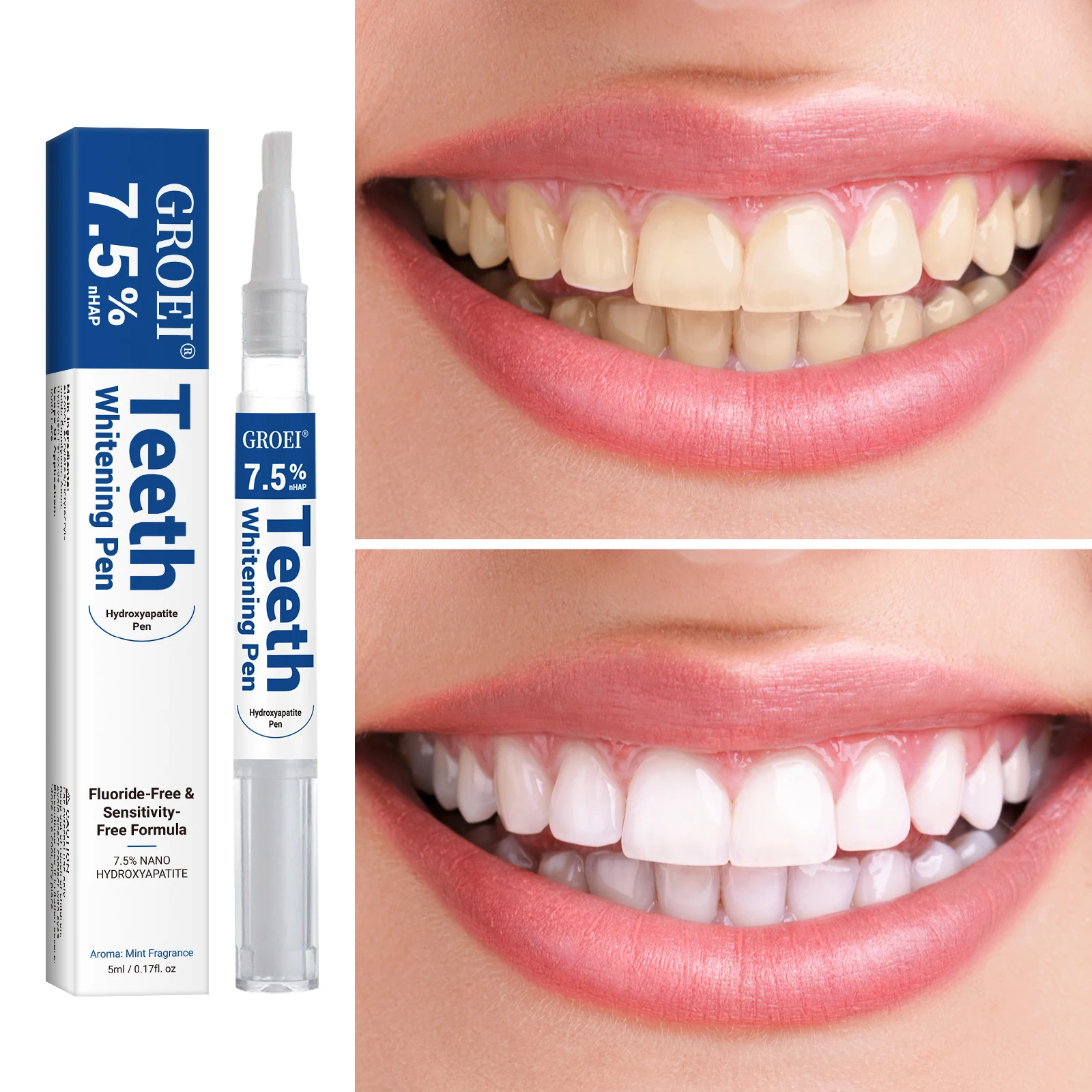 하이드록시아파타이트 치아 미백 펜 눈부신 화이트 얼룩  - Teeth Whitening Before And After 리뷰 및 가격