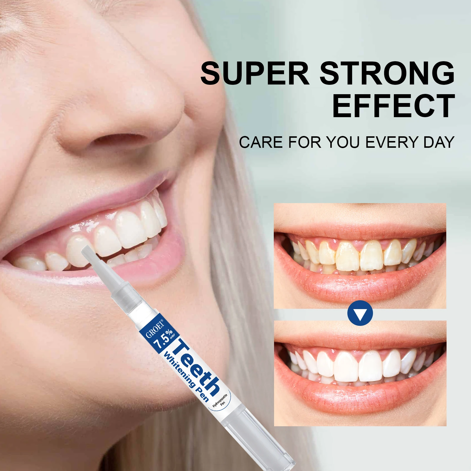 하이드록시아파타이트 치아 미백 펜 눈부신 화이트 얼룩  - Teeth Whitening Before And After 리뷰 및 가격