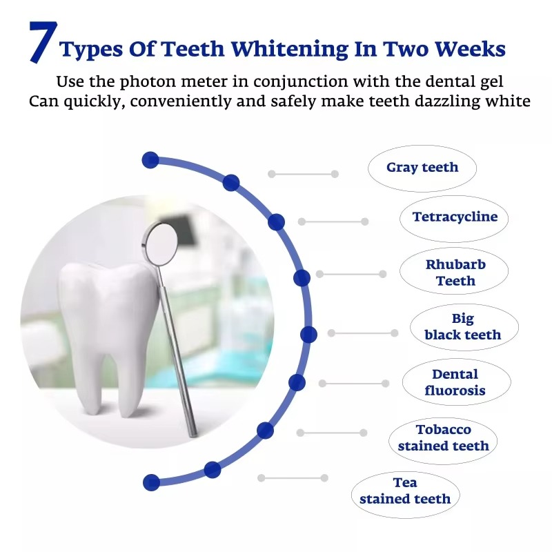 지능형 LED 블루 라이트 휴대용 USB/iPhone/ - Teeth Whitening Gum 리뷰 및 가격