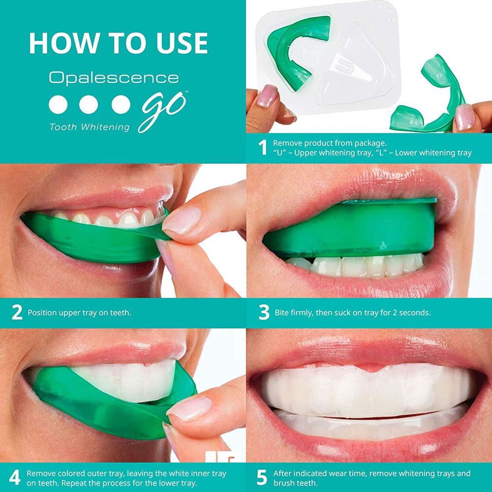 치아 미백용 과산화 수소, 유백광 고 프리필 트레이,  - Teeth Whitening Opalescence Go 리뷰 및 가격