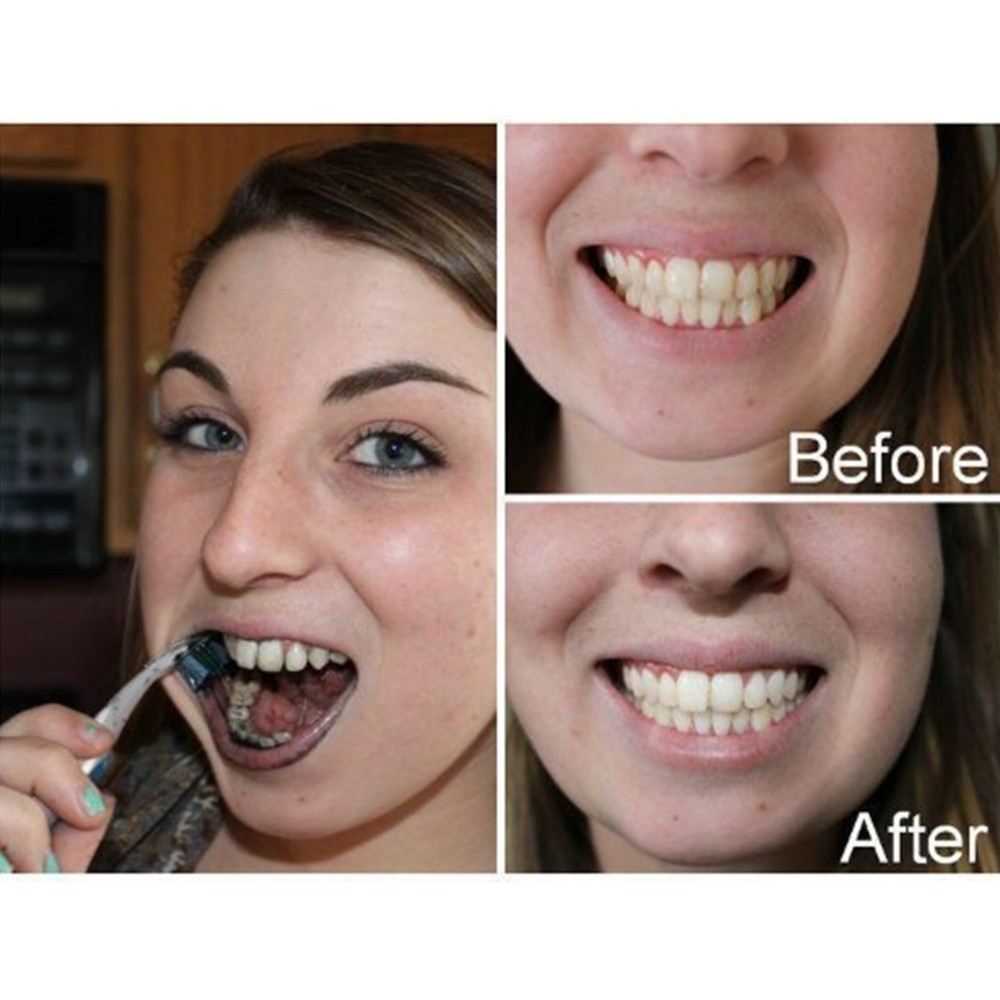 대나무 숯 치아 치아 Dentis Lab 구강 위생 관 - Teeth Whitening Filter 리뷰 및 가격