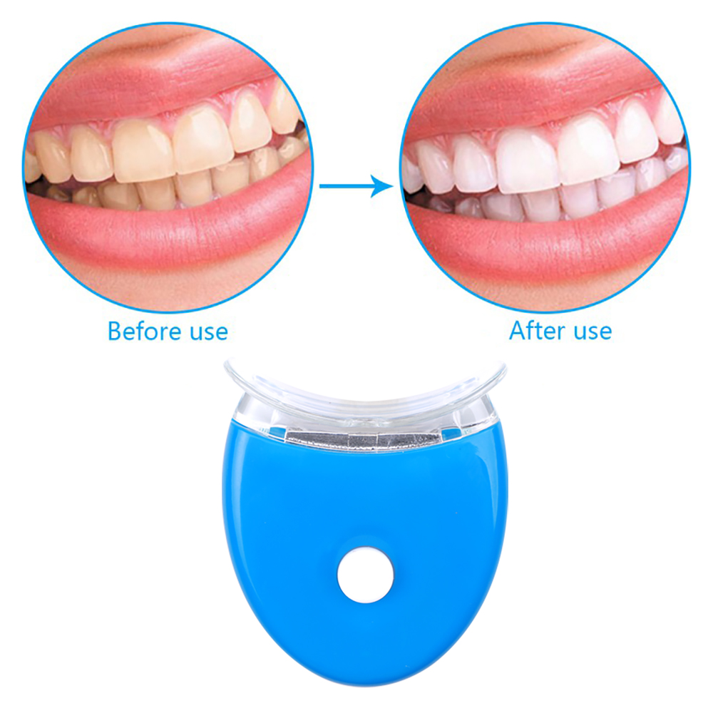 치아 미백 젤 키트 구강 위생 관리 치아 미백 도구 필 - Teeth Whitening Filter 리뷰 및 가격