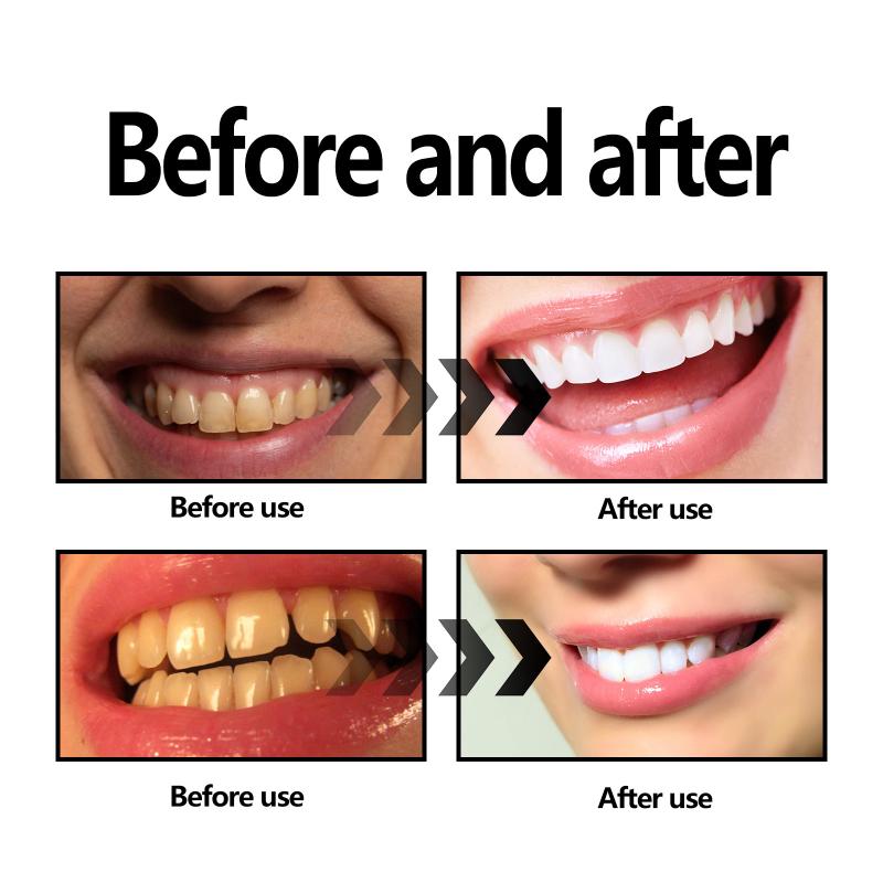 대나무 숯가루 치아 미백 천연 얼룩 제거 구강 청결 상 - Teeth Whitening Filter 리뷰 및 가격