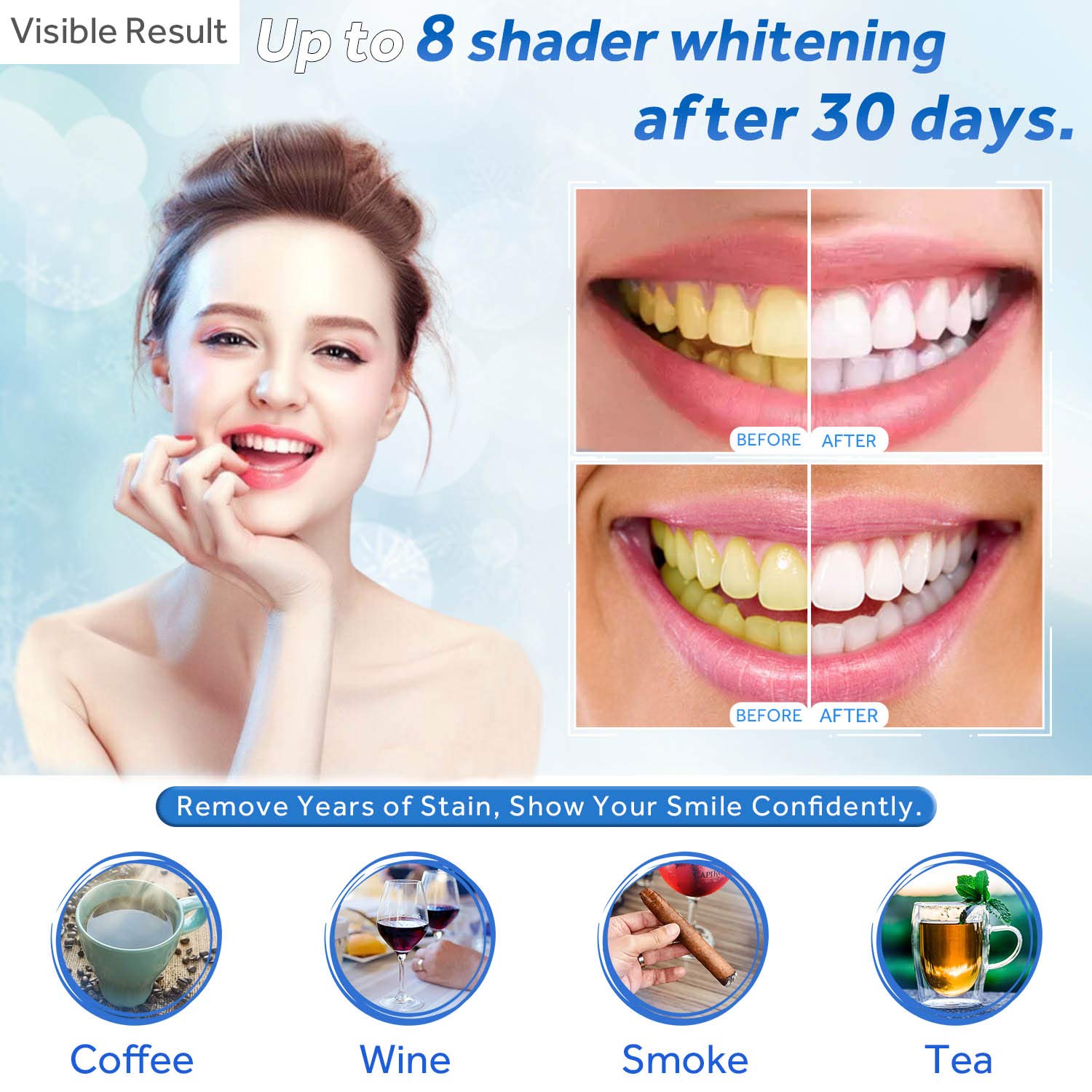 치아 미백 젤 리필 주사기 치아 미백 젤 인비스알라인  - Teeth Whitening Before And After 리뷰 및 가격
