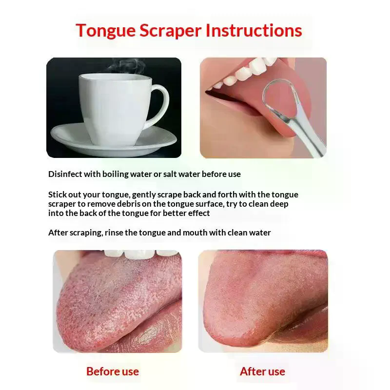 스테인리스 스틸 혀 클리너 세트 재사용 가능 금속 클리 - Tongue Scraper Metal 리뷰 및 가격