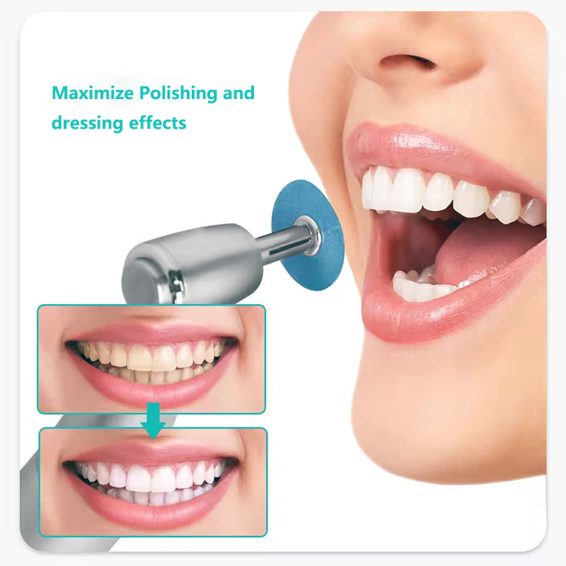40개 치과용 폴리싱 디스크 홀딩 로드 맨드렐 소플렉스 - Teeth Whitening Uk 리뷰 및 가격