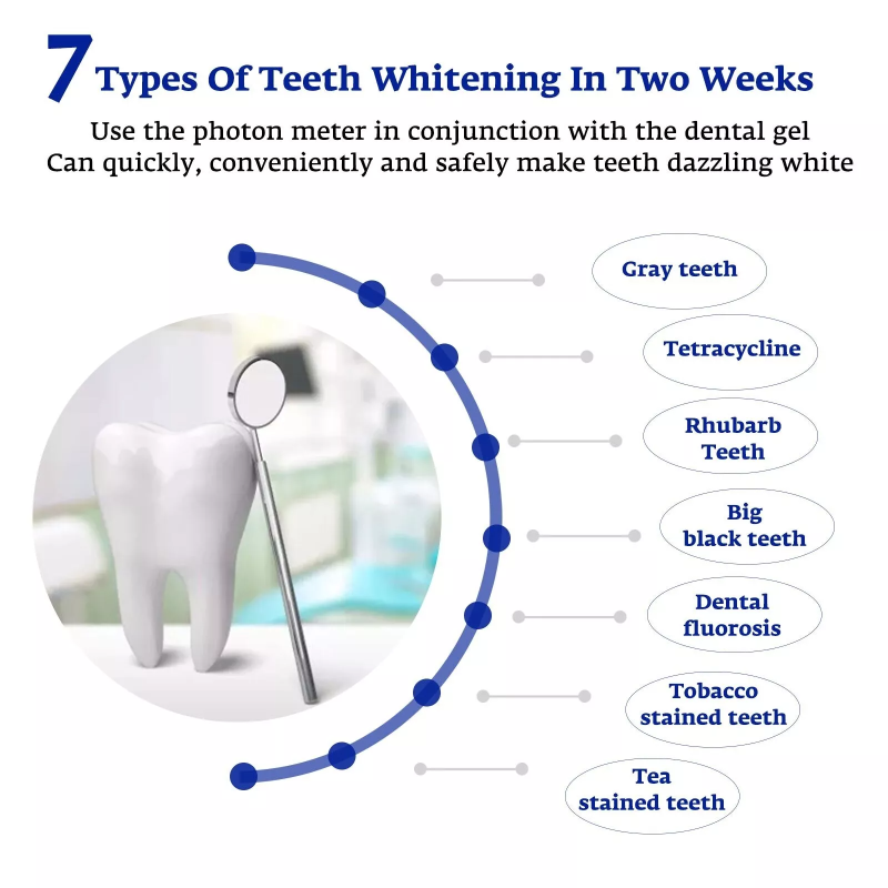 치아 미백 가속기 스마트 LED 블루 라이트 휴대용 U - Teeth Whitening Gum 리뷰 및 가격