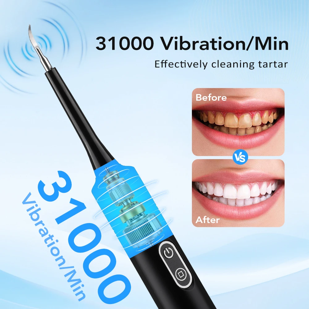 전동 음파 진동 치석 제거기 치아 미백 플라그 제거 치 - Teeth Whitening Uk 리뷰 및 가격