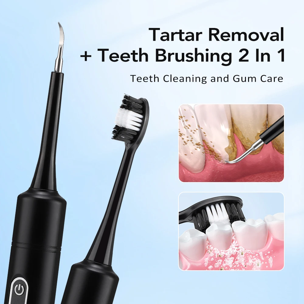 전동 음파 진동 치석 제거기 치아 미백 플라그 제거 치 - Teeth Whitening Uk 리뷰 및 가격